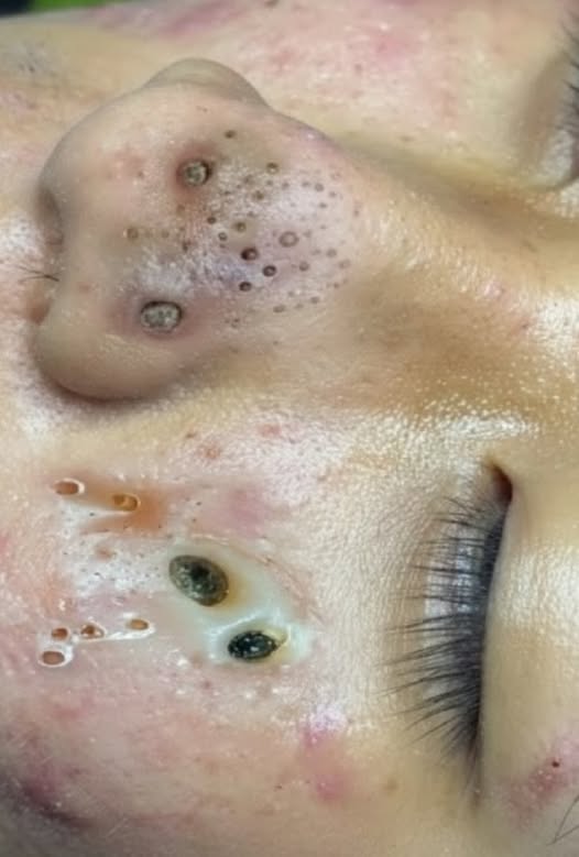 What the EU Is Saying About Sugar Taxes and Health