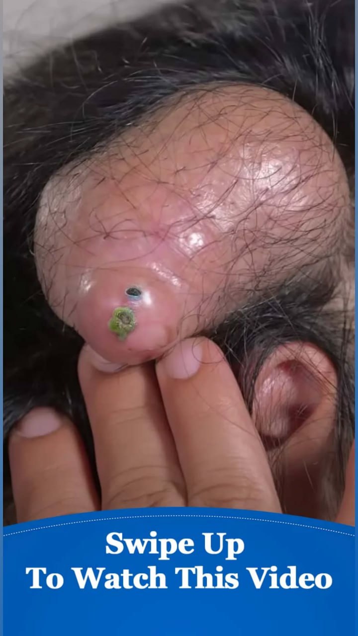 Everyday Habits That Reduce Anxiety Naturally