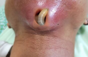 Coping With Stress After a Long Pandemic